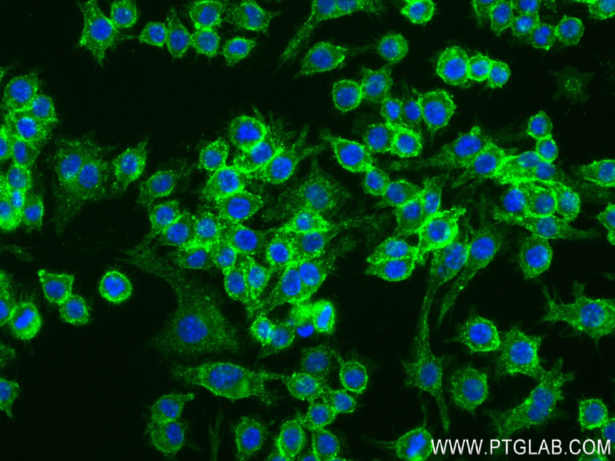 Immunofluorescence (IF) / fluorescent staining of RAW 264.7 cells using CD14 Recombinant antibody (83297-7-RR)