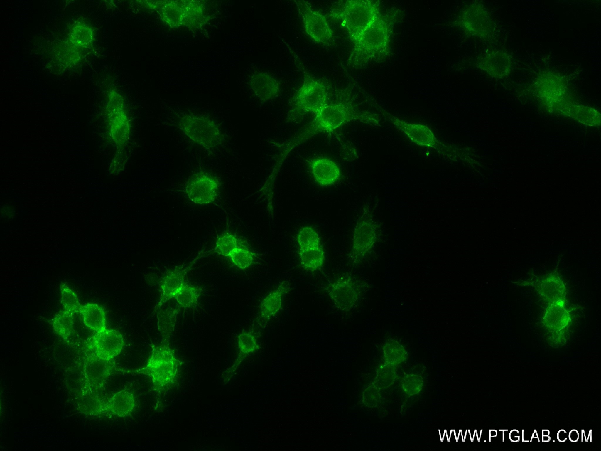 Immunofluorescence (IF) / fluorescent staining of RAW 264.7 cells using Anti-Mouse CD14 Rabbit Recombinant Antibody (98020-1-RR)