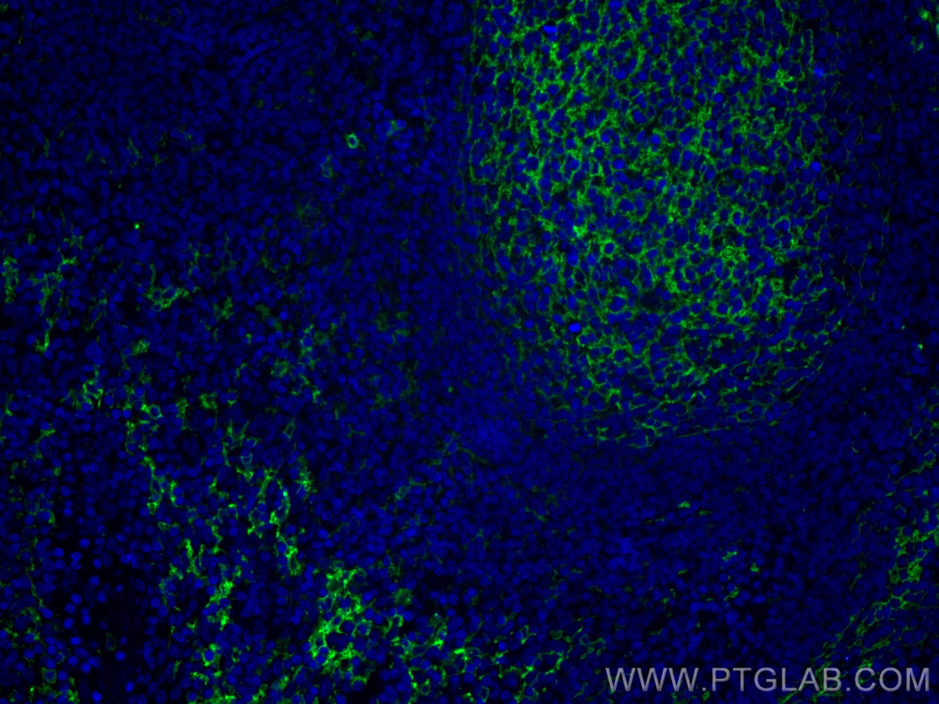 Immunofluorescence (IF) / fluorescent staining of human tonsillitis tissue using CoraLite® Plus 488-conjugated CD14 Polyclonal anti (CL488-17000)