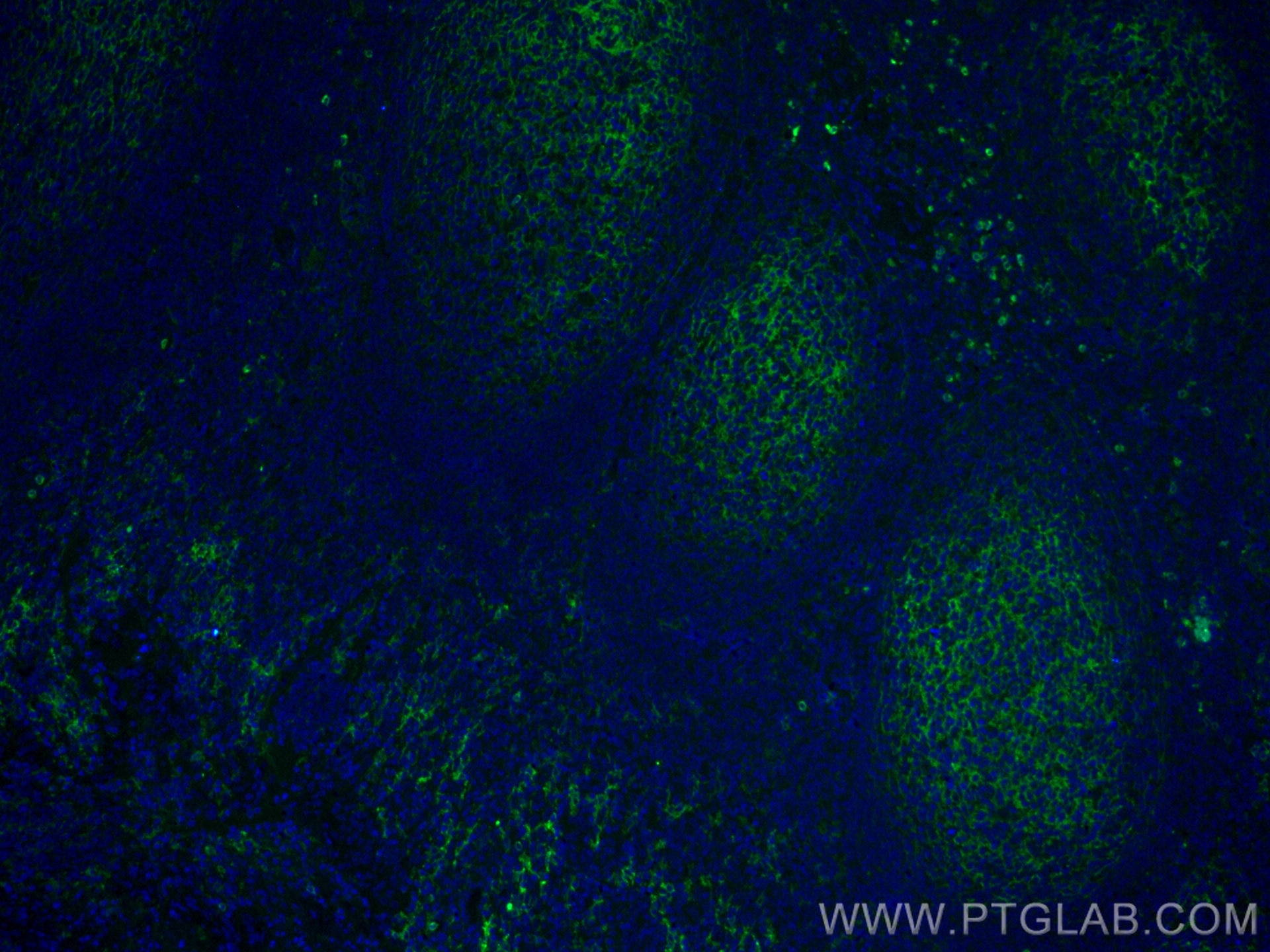 Immunofluorescence (IF) / fluorescent staining of human tonsillitis tissue using CoraLite® Plus 488-conjugated CD14 Polyclonal anti (CL488-17000)