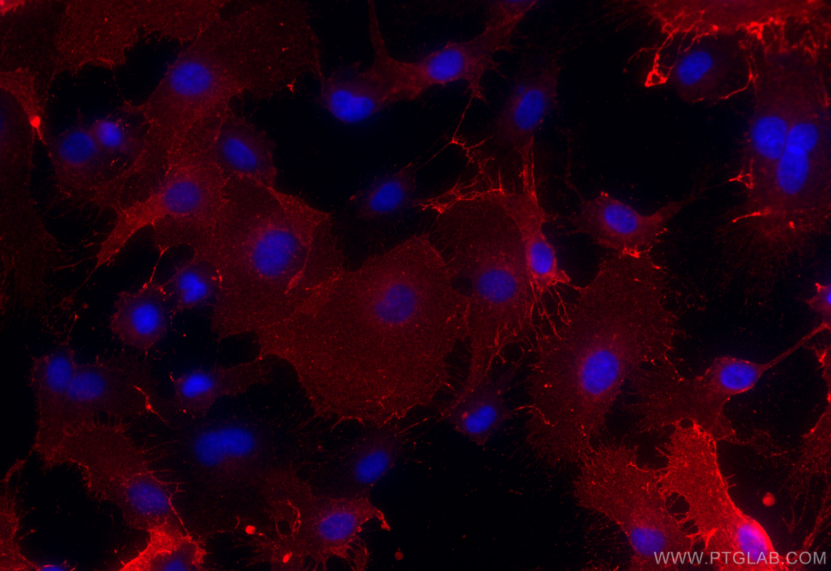 Immunofluorescence (IF) / fluorescent staining of HUVEC cells using CD141/Thrombomodulin Polyclonal antibody (31339-1-AP)