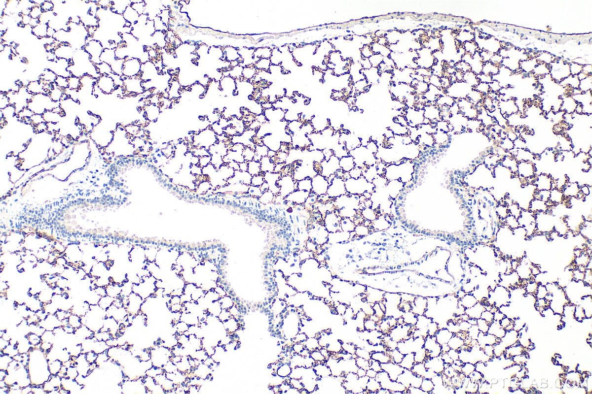 CD141/Thrombomodulin