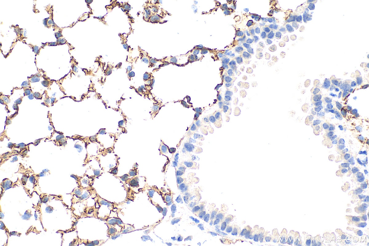 Immunohistochemistry (IHC) staining of mouse lung tissue using CD141/Thrombomodulin Polyclonal antibody (31339-1-AP)