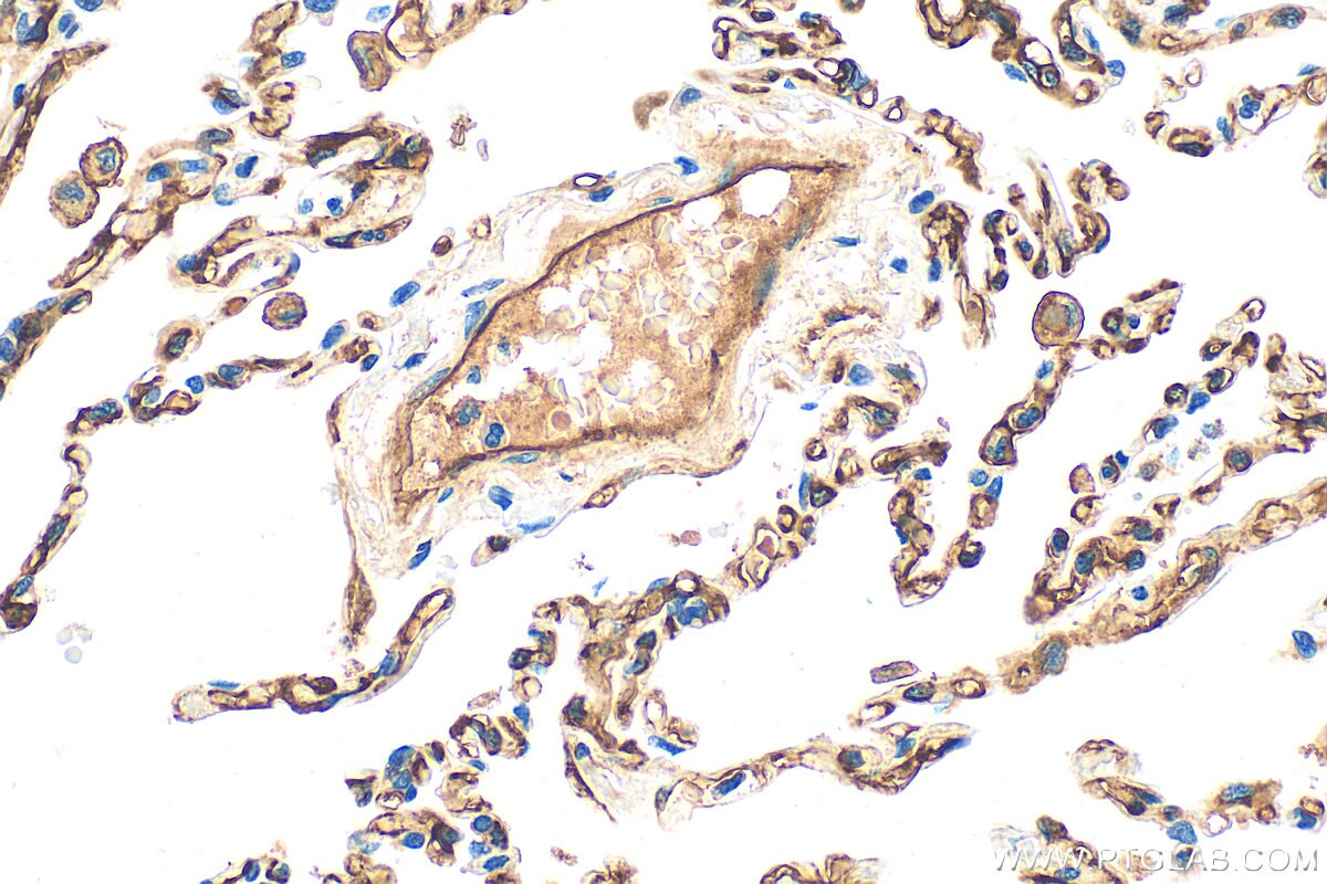 Immunohistochemistry (IHC) staining of human lung tissue using CD141/Thrombomodulin Polyclonal antibody (31339-1-AP)