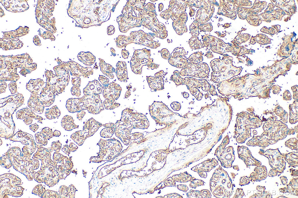 Immunohistochemistry (IHC) staining of human placenta tissue using CD141/Thrombomodulin Polyclonal antibody (31339-1-AP)
