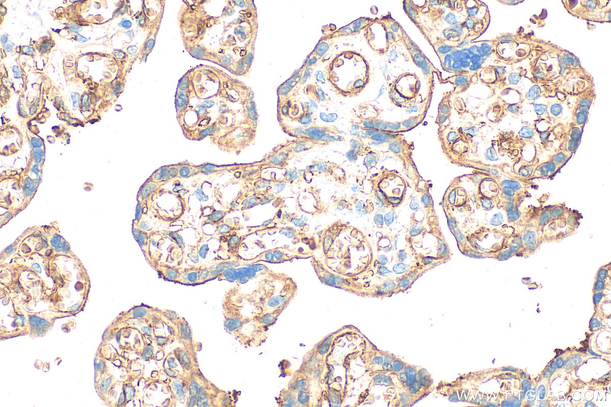 Immunohistochemistry (IHC) staining of human placenta tissue using CD141/Thrombomodulin Polyclonal antibody (31339-1-AP)