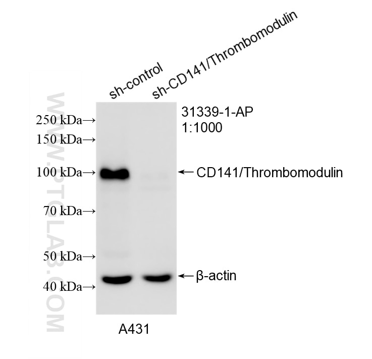 WB result of CD141/Thrombomodulin antibody (31339-1-AP; 1:1000; incubated at room temperature for 1.5 hours) with sh-Control and sh-CD141/Thrombomodulin transfected A431 cells. Western Blot (WB) analysis of A431 cells using CD141/Thrombomodulin Polyclonal antibody (31339-1-AP)