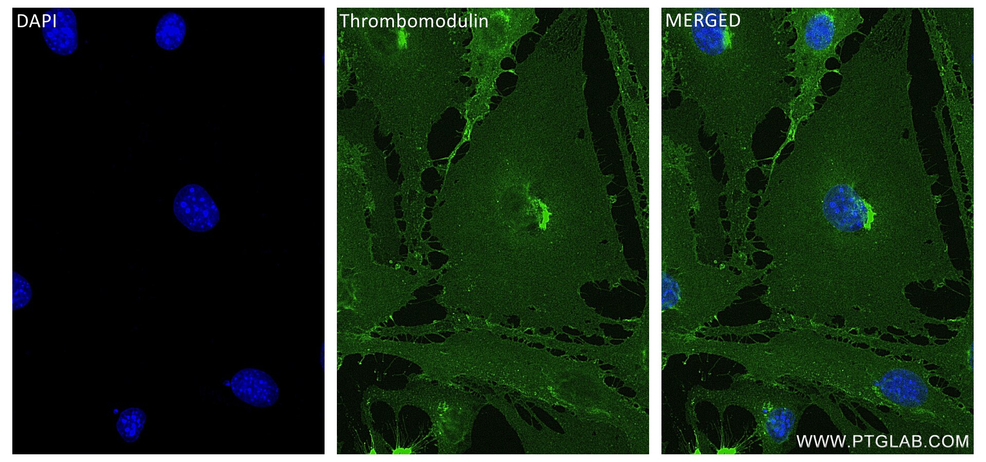 Immunofluorescence (IF) / fluorescent staining of bEnd.3 cells using CD141/Thrombomodulin Recombinant antibody (84412-3-RR)