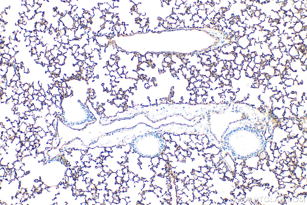 Immunohistochemistry (IHC) staining of mouse lung tissue using CD141/Thrombomodulin Recombinant antibody (84412-3-RR)