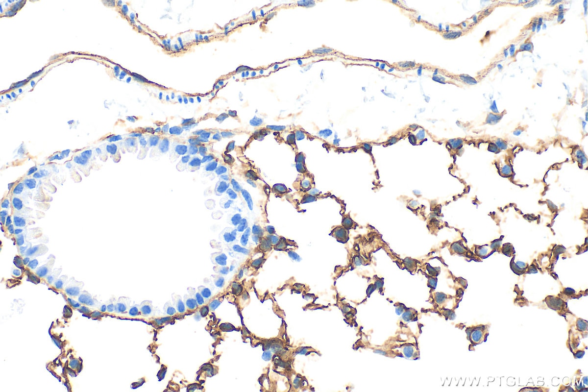 Immunohistochemistry (IHC) staining of mouse lung tissue using CD141/Thrombomodulin Recombinant antibody (84412-3-RR)