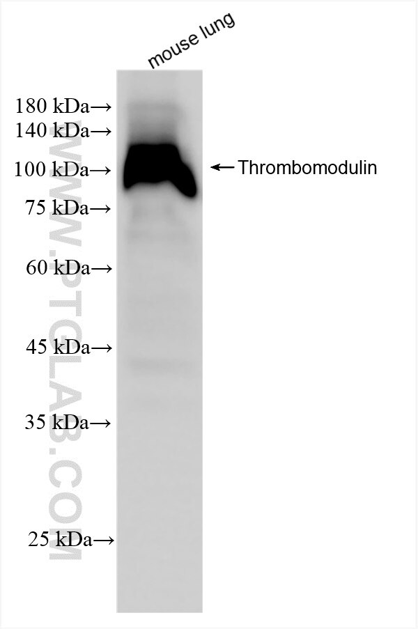 Western Blot (WB) analysis of mouse lung tissue using CD141/Thrombomodulin Recombinant antibody (84412-3-RR)
