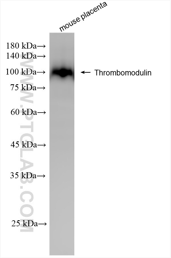 Western Blot (WB) analysis of mouse placenta tissue using CD141/Thrombomodulin Recombinant antibody (84412-3-RR)