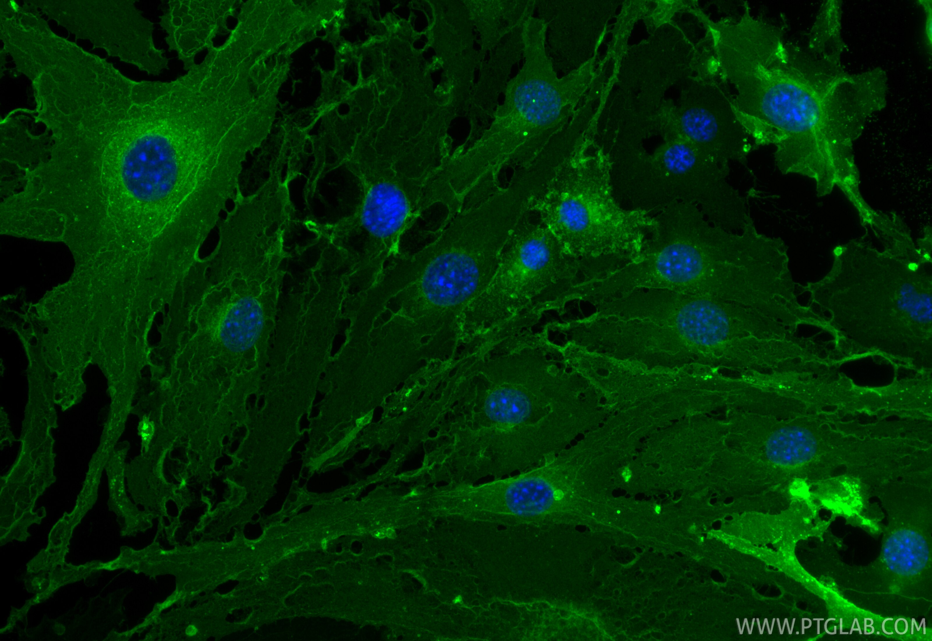 IF Staining of bEnd.3 using CL488-84412-3 Immunofluorescence (IF) / fluorescent staining of bEnd.3 cells using CoraLite® Plus 488-conjugated CD141/Thrombomodulin (CL488-84412-3)