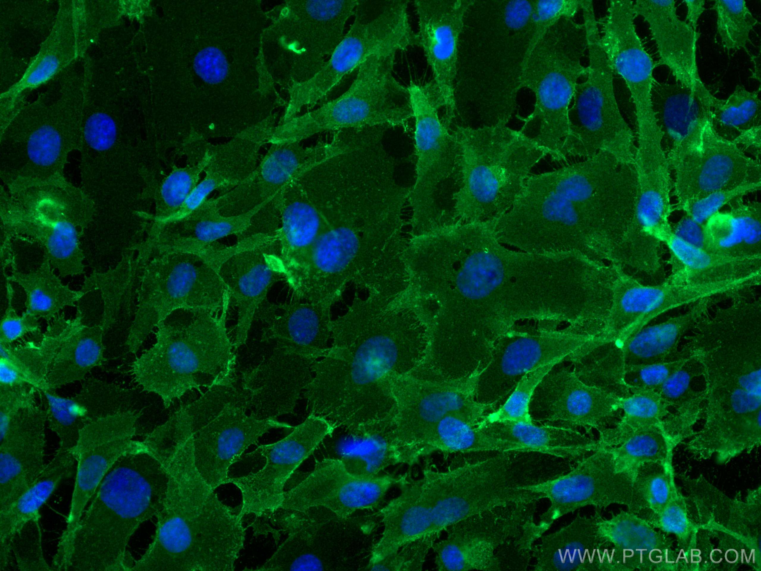 Immunofluorescence (IF) / fluorescent staining of HUVEC cells using CD146/MCAM Monoclonal antibody (66153-1-Ig)