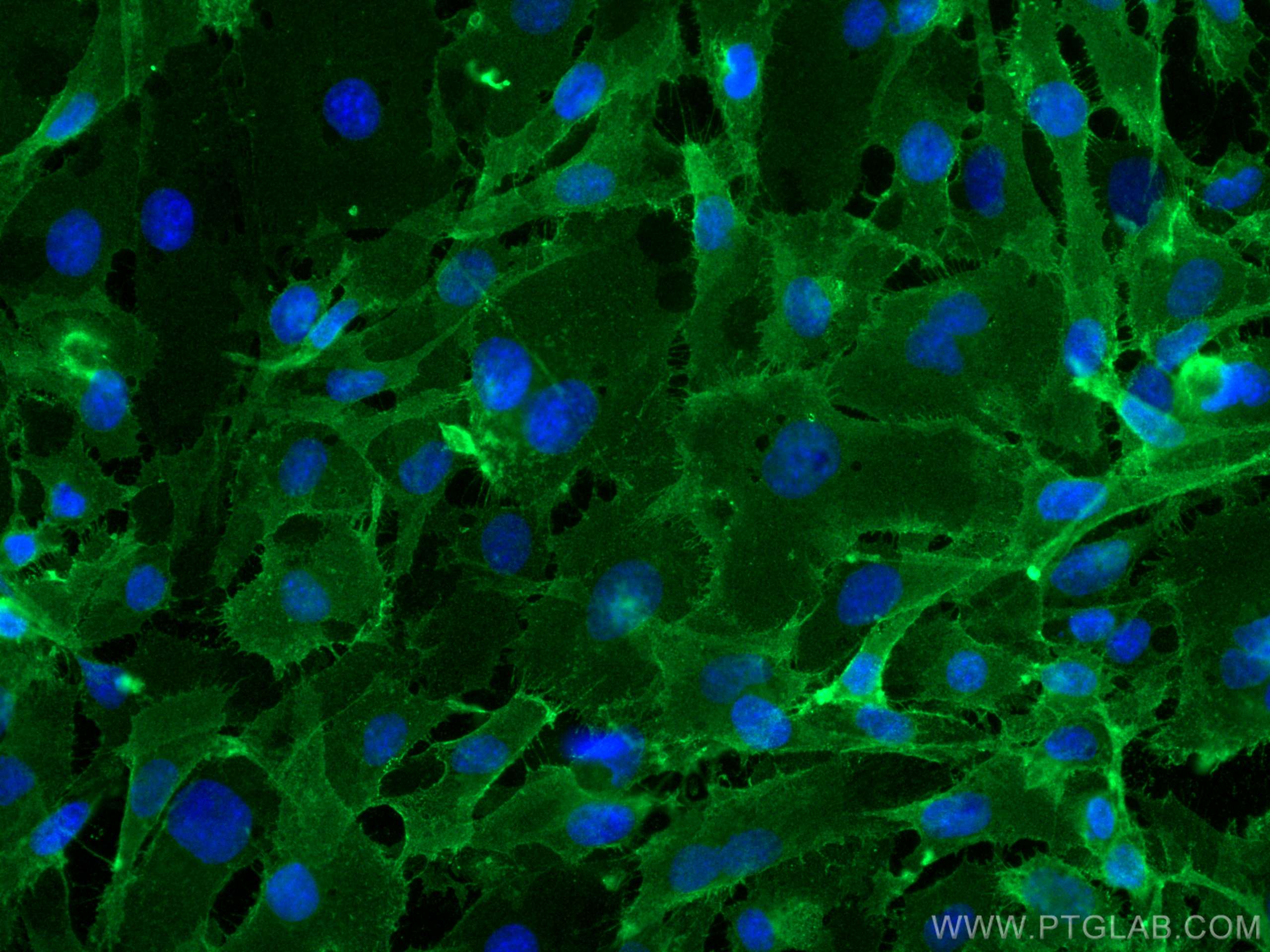 IF Staining of HUVEC using 66153-1-Ig