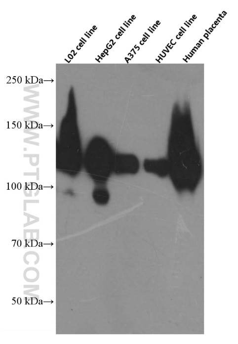 Western Blot (WB) analysis of various lysates using CD146/MCAM Monoclonal antibody (66153-1-Ig)