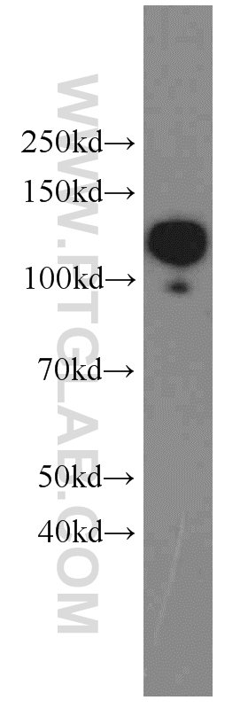 Western Blot (WB) analysis of HeLa cells using CD146/MCAM Monoclonal antibody (66153-1-Ig)