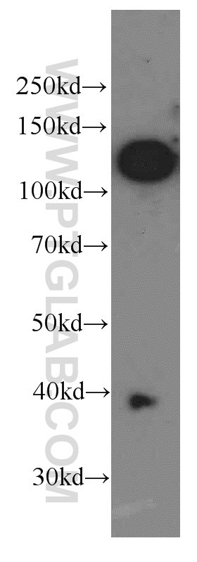 Western Blot (WB) analysis of A375 cells using CD146/MCAM Monoclonal antibody (66153-1-Ig)