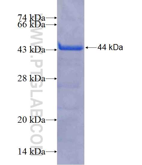 CD146, MCAM fusion protein Ag11855 SDS-PAGE