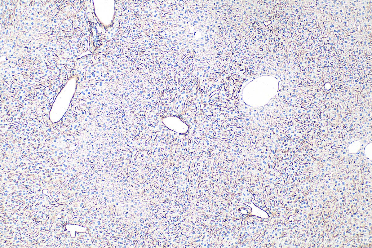 Immunohistochemistry (IHC) staining of mouse liver tissue using CD146/MCAM Polyclonal antibody (33091-1-AP)