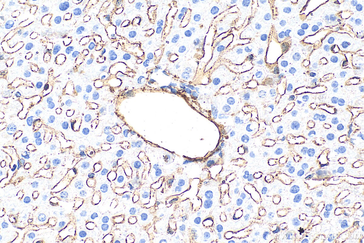 Immunohistochemistry (IHC) staining of mouse liver tissue using CD146/MCAM Polyclonal antibody (33091-1-AP)