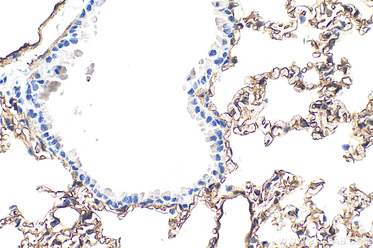 Immunohistochemistry (IHC) staining of mouse lung tissue using CD146/MCAM Polyclonal antibody (33091-1-AP)