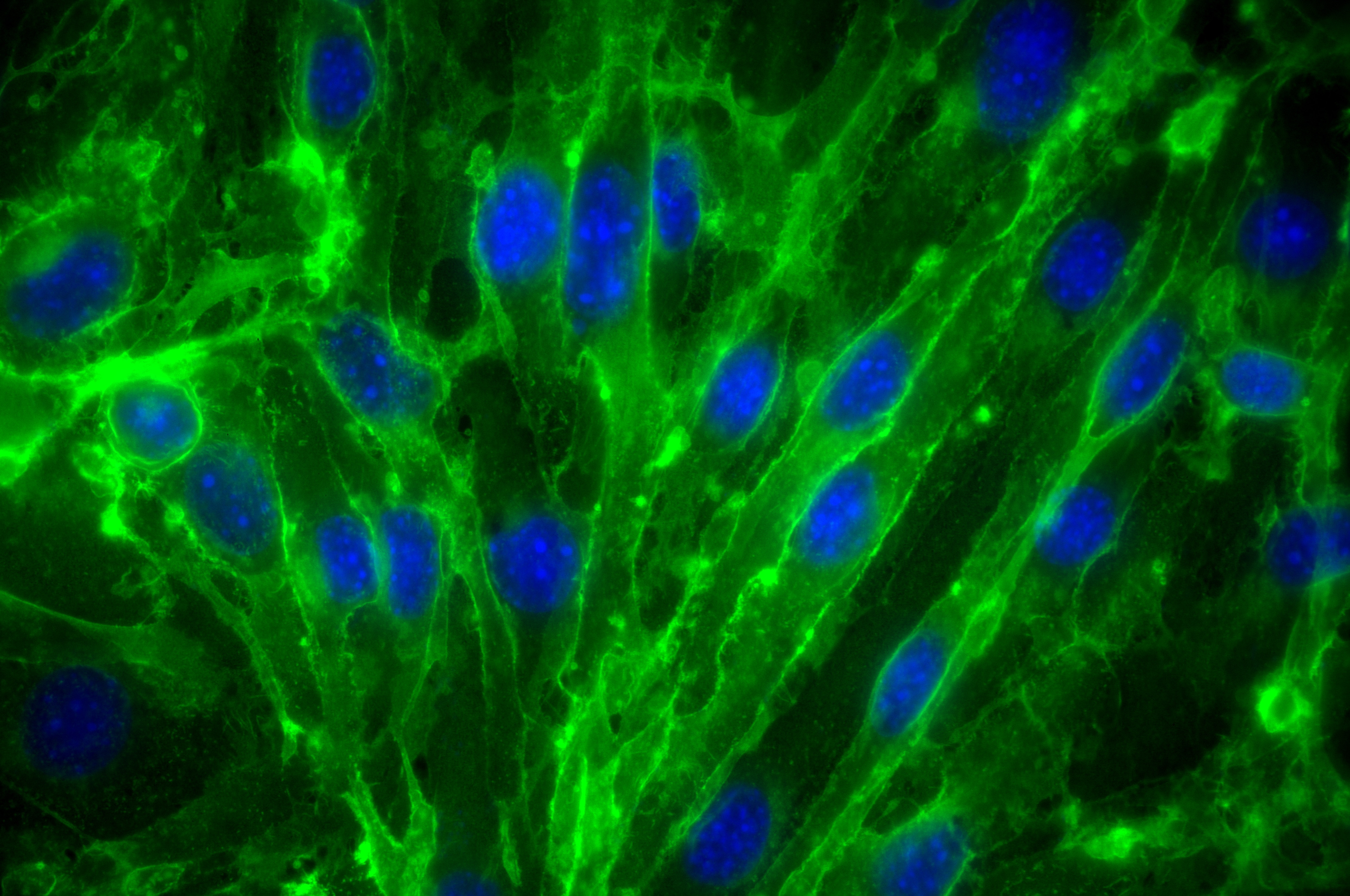 Immunofluorescence (IF) / fluorescent staining of bEnd.3 cells using CD146/MCAM Recombinant antibody (86159-3-RR)