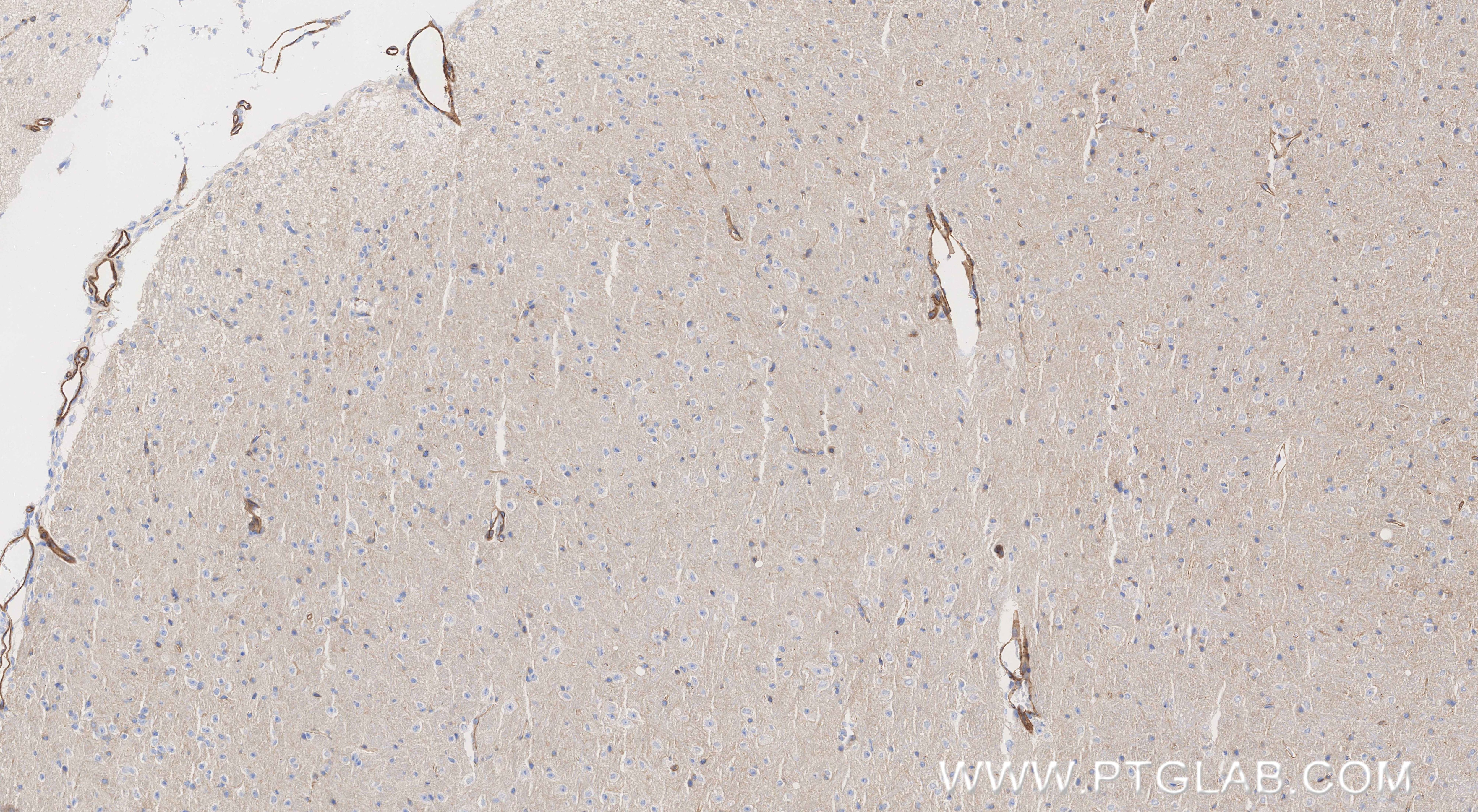 Immunohistochemistry (IHC) staining of mouse brain tissue using CD146/MCAM Recombinant monoclonal antibody (86159-3-RR)