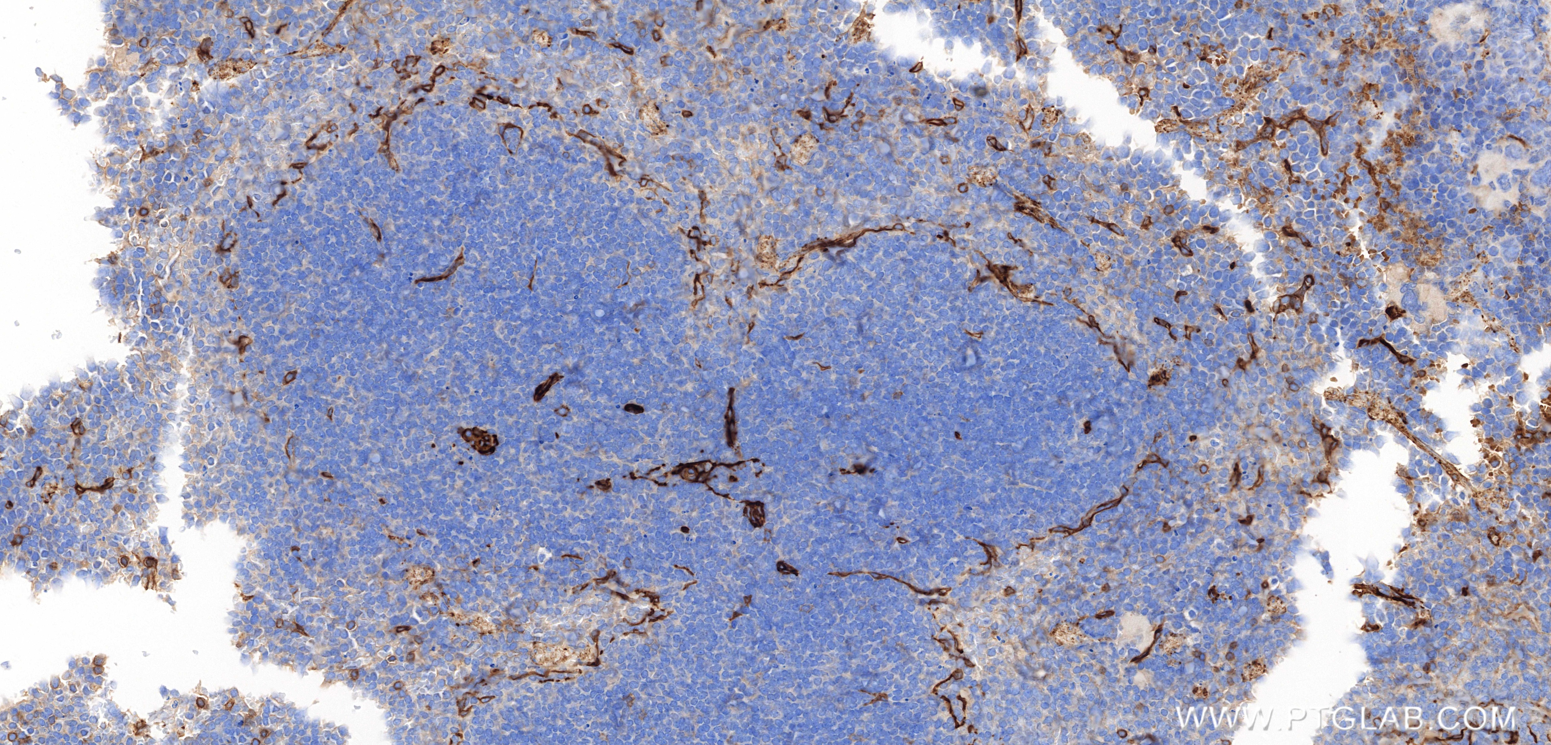 Immunohistochemistry (IHC) staining of mouse spleen tissue using CD146/MCAM Recombinant monoclonal antibody (86159-3-RR)