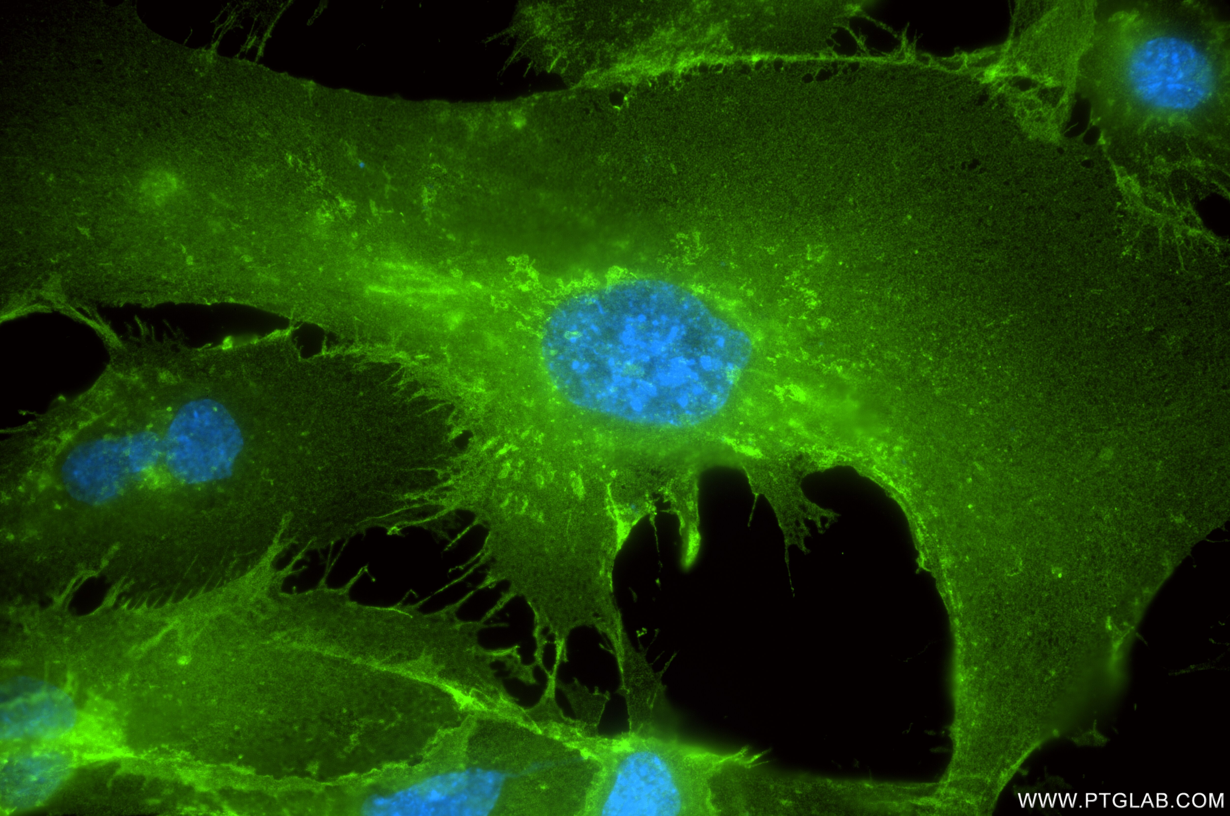 Immunofluorescence (IF) / fluorescent staining of HUVEC cells using CD146/MCAM Recombinant antibody (86492-1-RR)