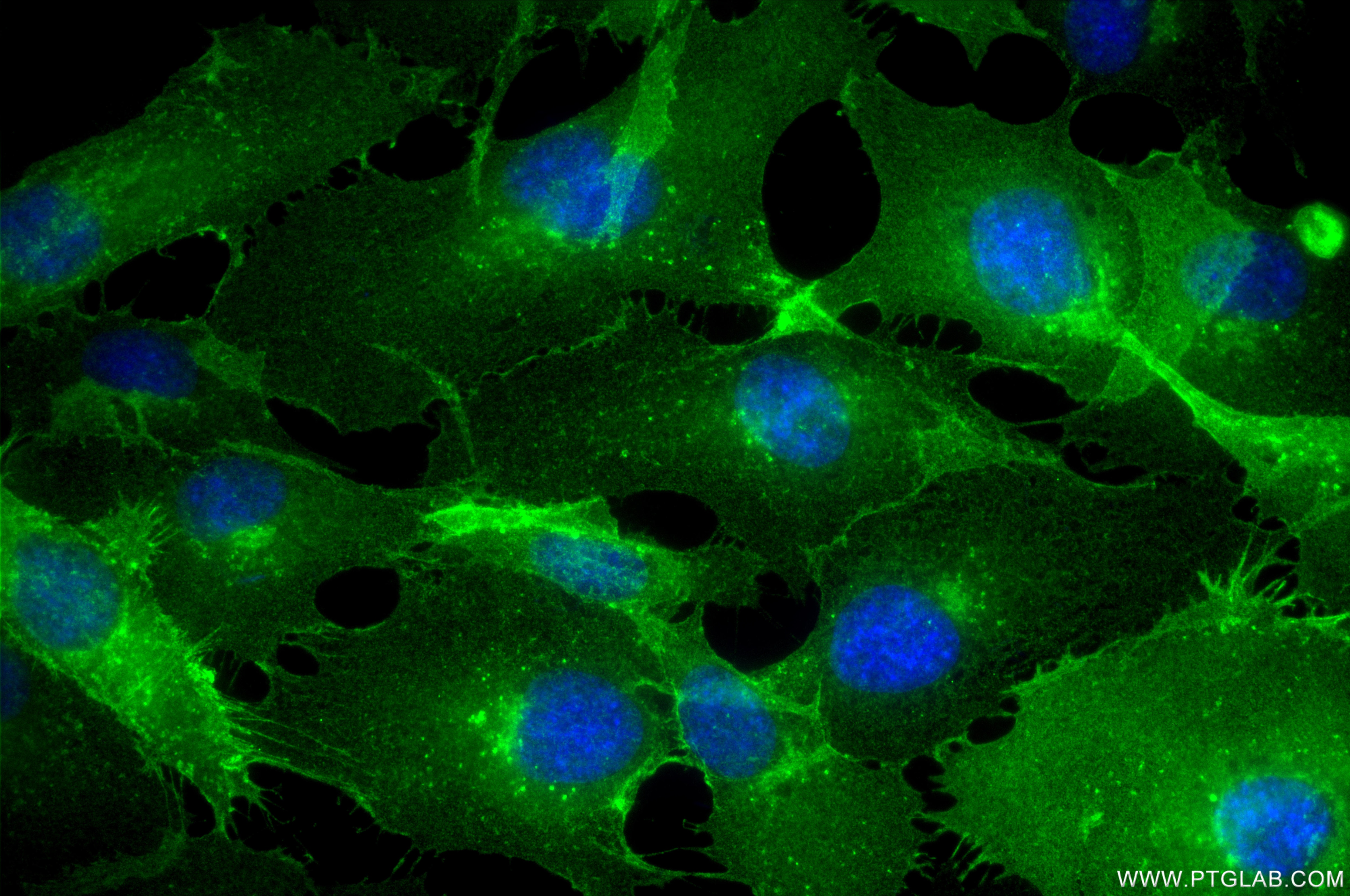 Immunofluorescence (IF) / fluorescent staining of HUVEC cells using CD146/MCAM Recombinant monoclonal antibody (86492-1-RR)