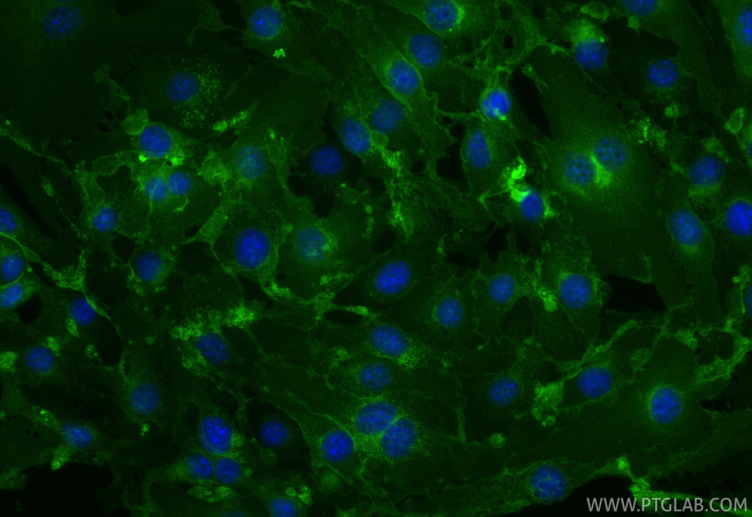 Immunofluorescence (IF) / fluorescent staining of bEnd.3 cells using CoraLite® Plus 488-conjugated CD146/MCAM Recombina (CL488-86159-3)