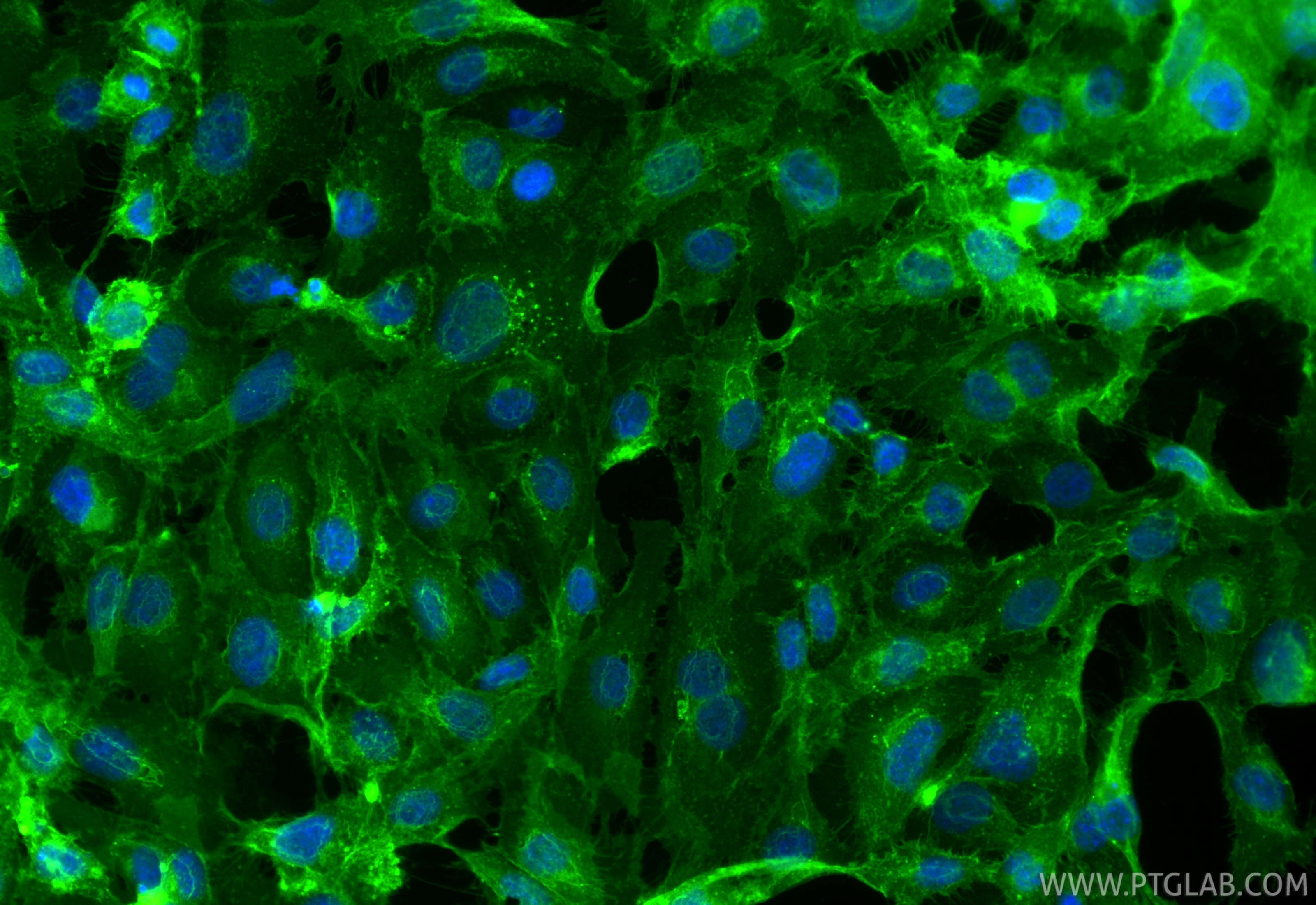 Immunofluorescence (IF) / fluorescent staining of HUVEC cells using CoraLite® Plus 488-conjugated CD146/MCAM Recombina (CL488-86492)