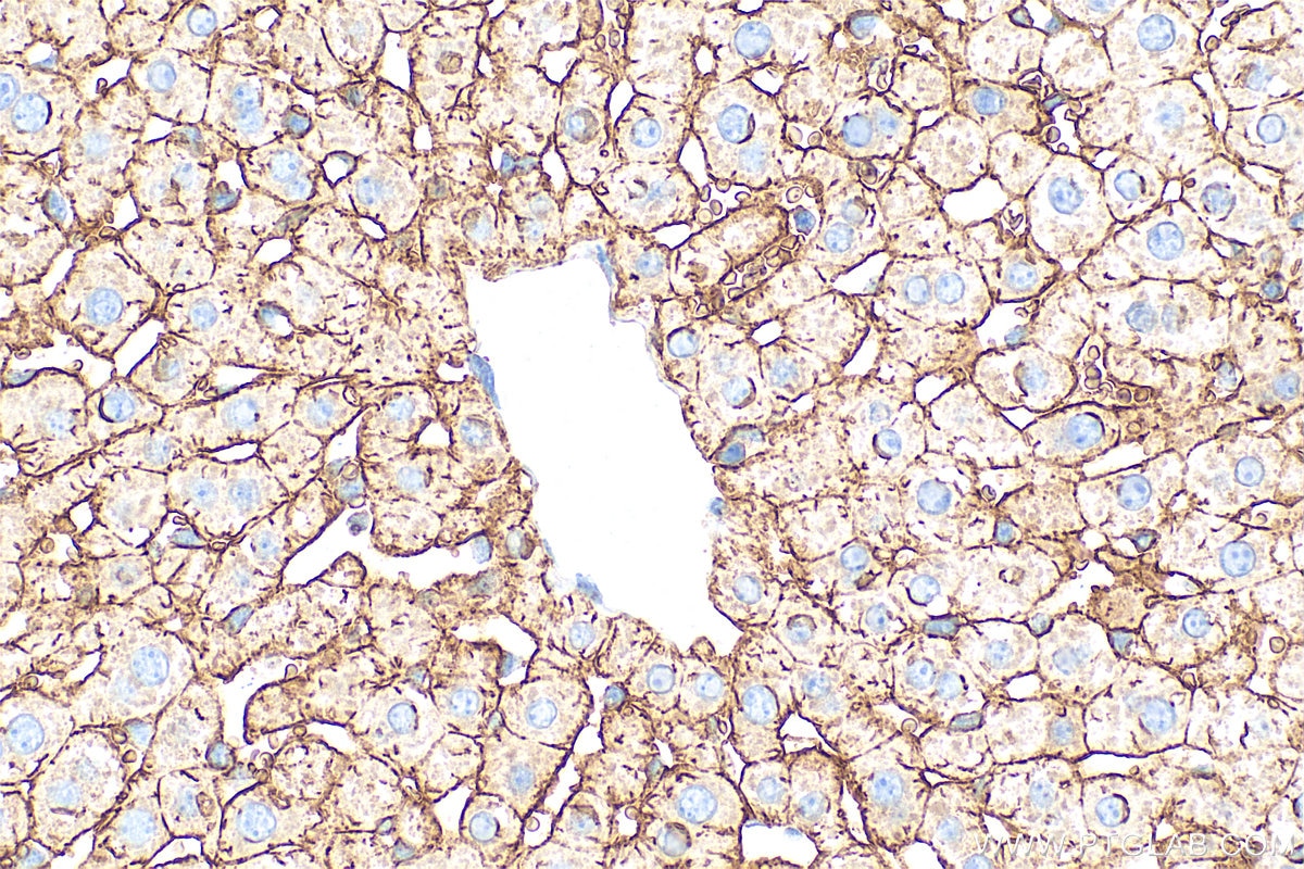 Immunohistochemistry (IHC) staining of mouse liver tissue using CD147 Polyclonal antibody (32187-1-AP)