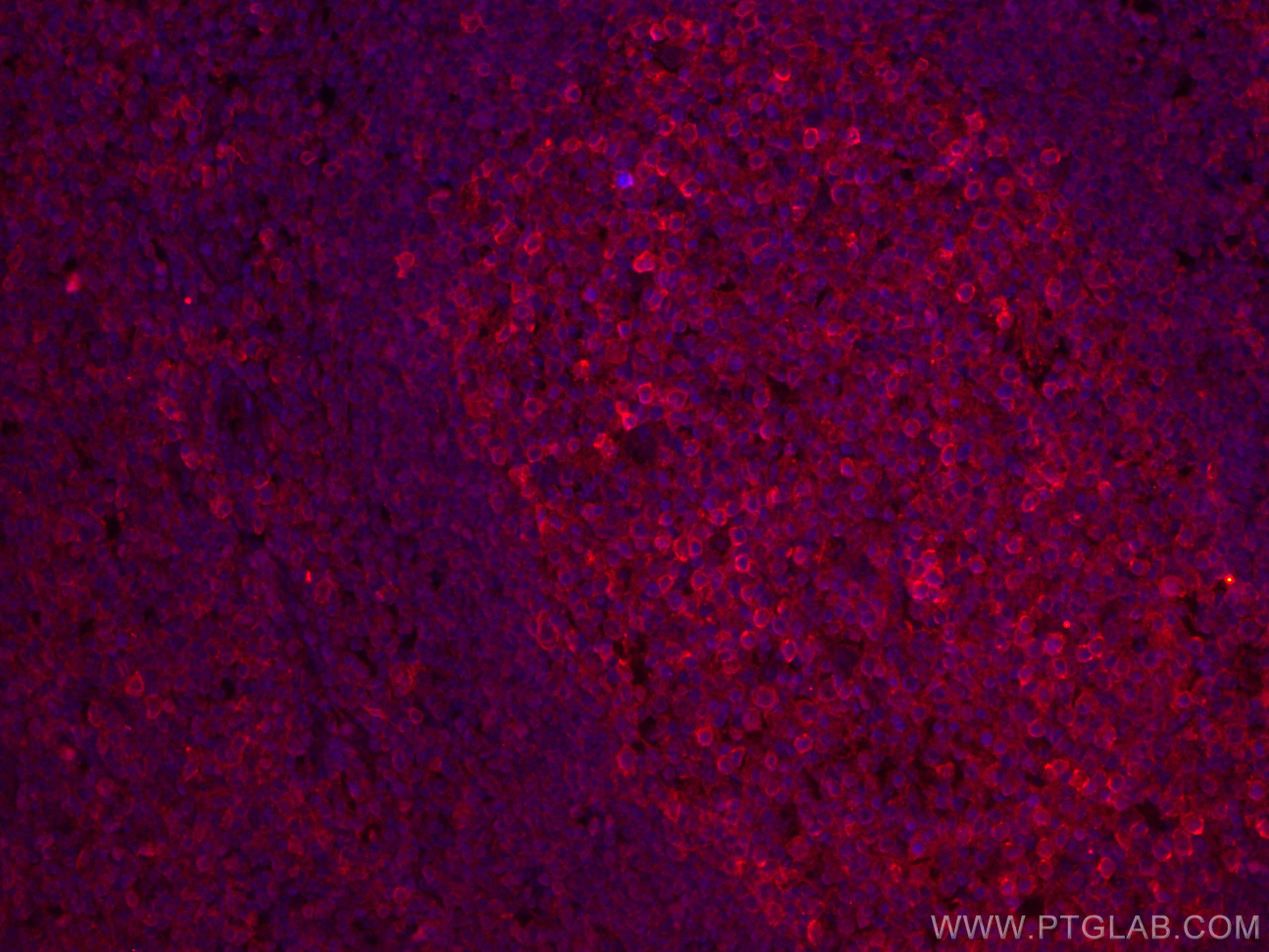 Immunofluorescence (IF) / fluorescent staining of human tonsillitis tissue using CD147 Monoclonal antibody (66443-1-Ig)