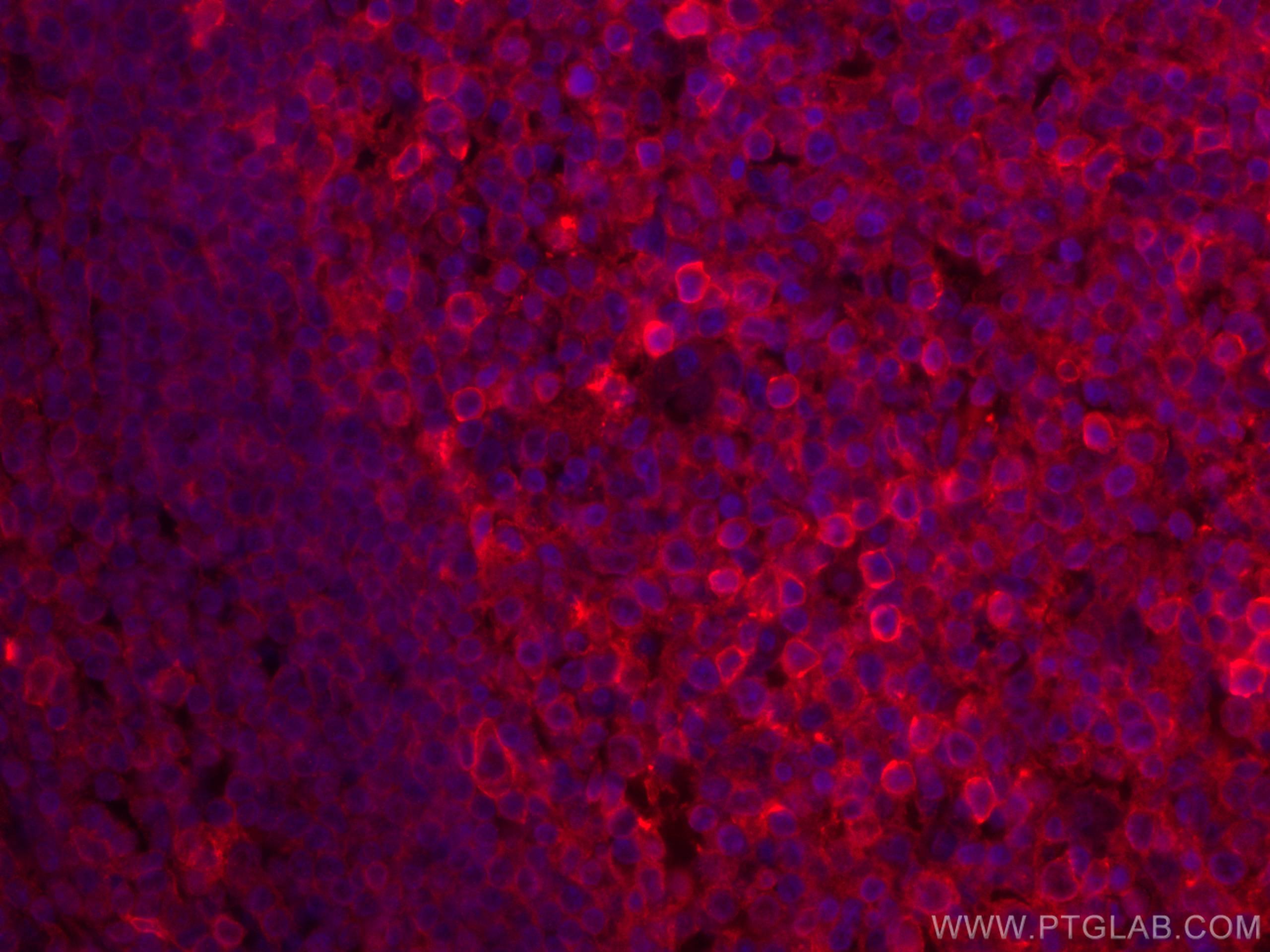 Immunofluorescence (IF) / fluorescent staining of human tonsillitis tissue using CD147 Monoclonal antibody (66443-1-Ig)