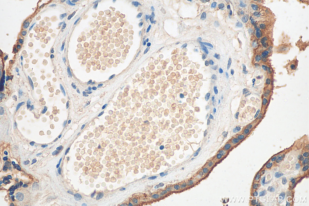 Immunohistochemistry (IHC) staining of human placenta tissue using CD147 Monoclonal antibody (66443-1-Ig)