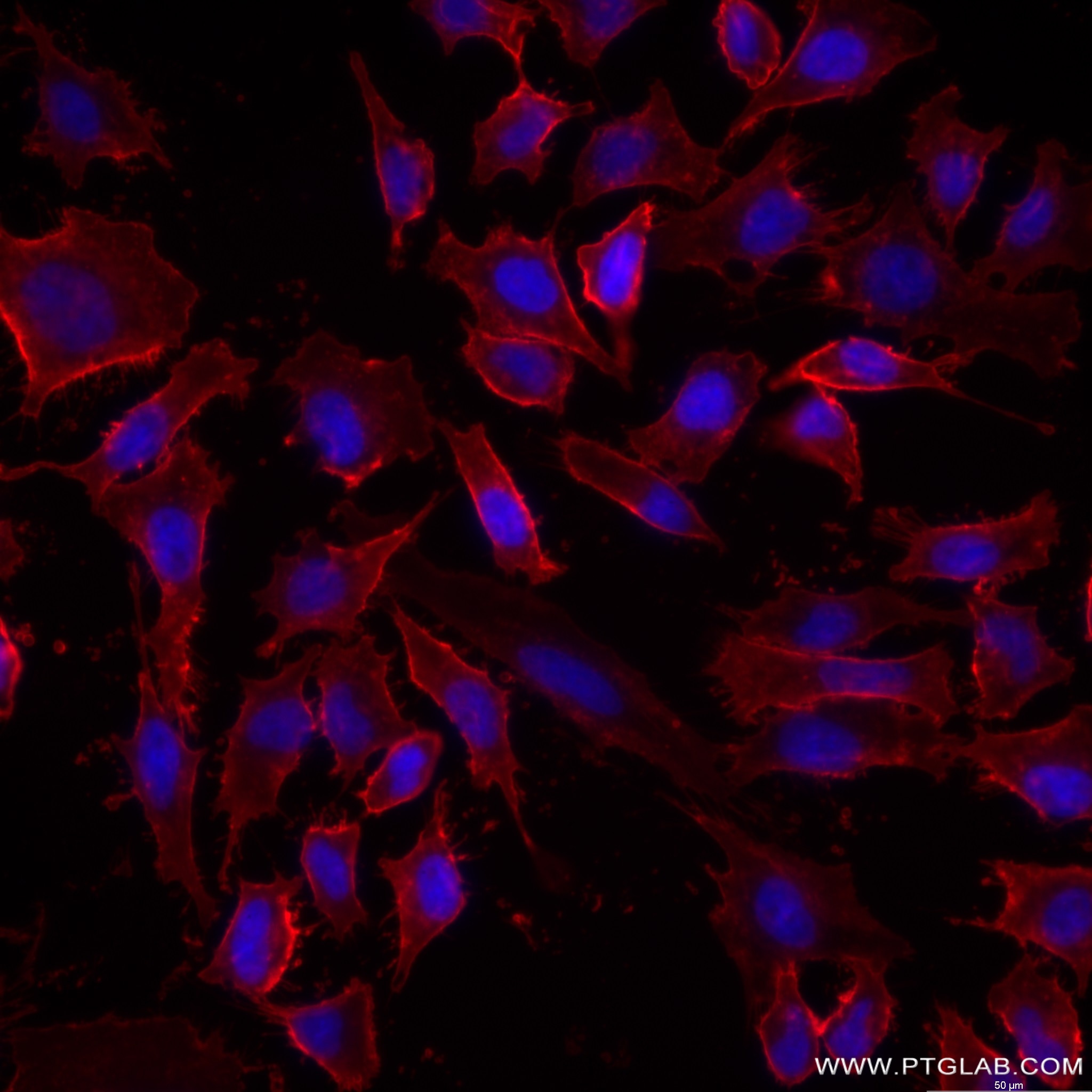 Immunofluorescence (IF) / fluorescent staining of HeLa cells using CD147 Recombinant antibody (82909-1-RR)