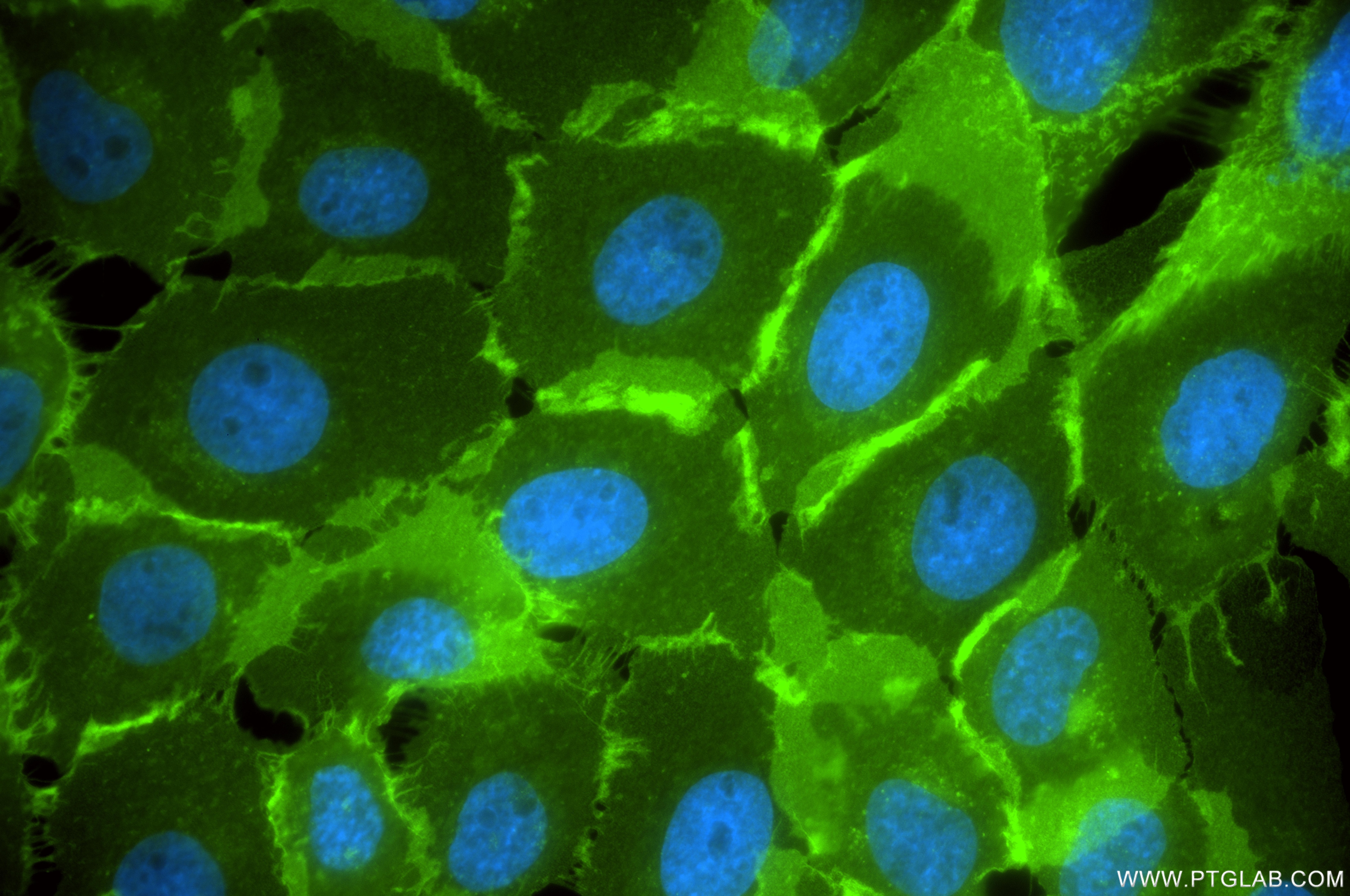 Immunofluorescence (IF) / fluorescent staining of A431 cells using CD147 Recombinant monoclonal antibody (82909-8-RR)