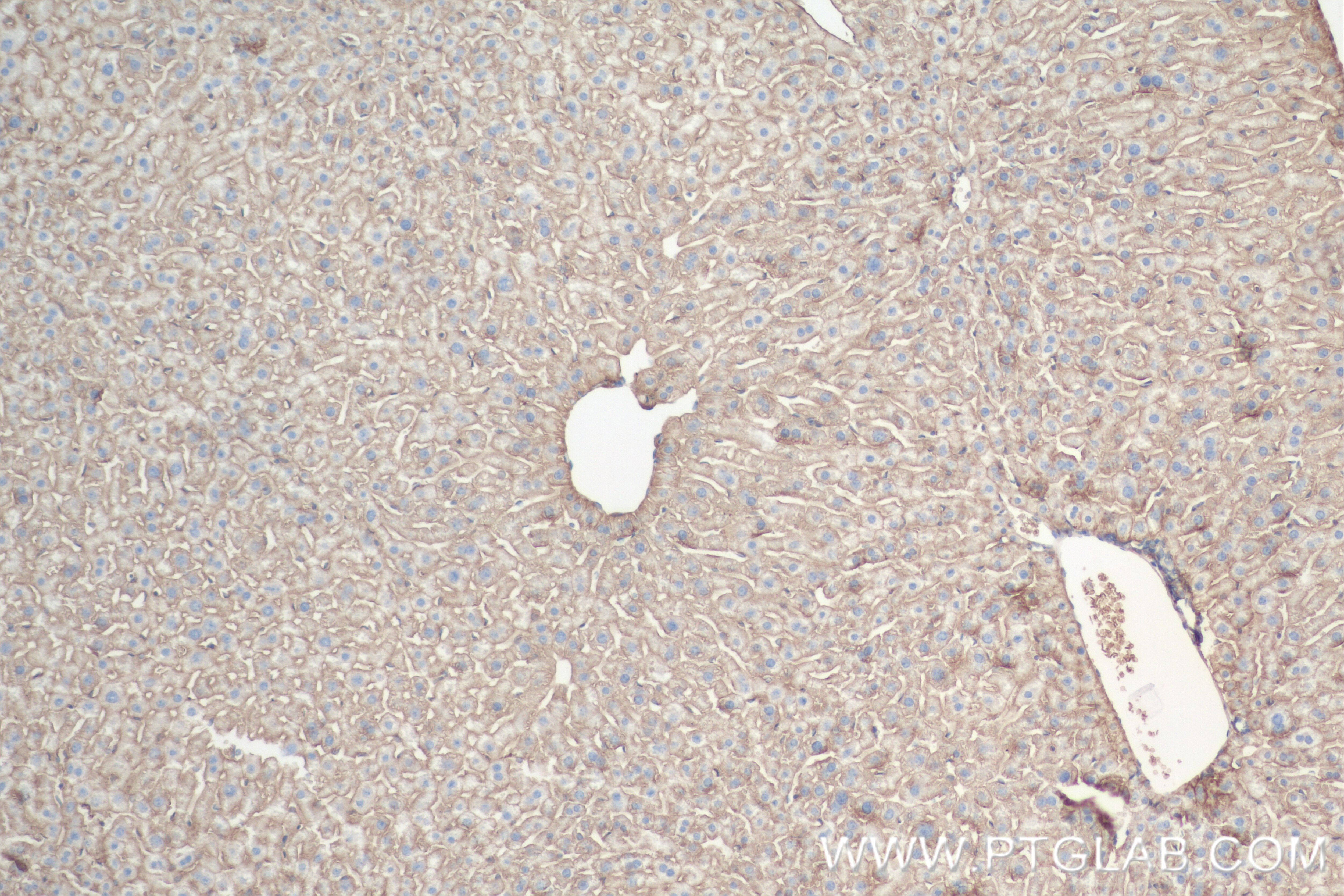 Immunohistochemistry (IHC) staining of mouse liver tissue using CD147 Recombinant antibody (84488-6-RR)