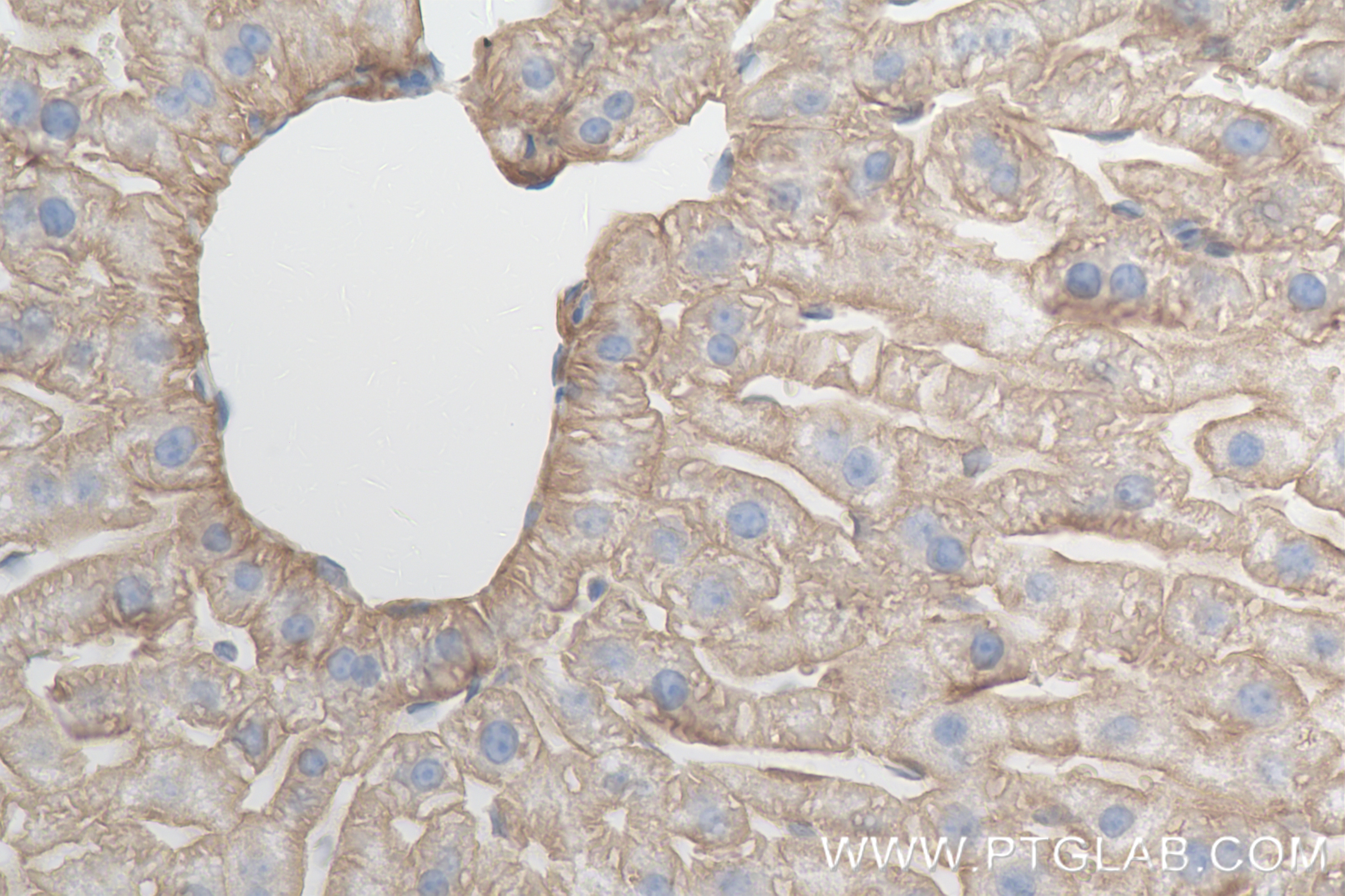 Immunohistochemistry (IHC) staining of mouse liver tissue using CD147 Recombinant antibody (84488-6-RR)
