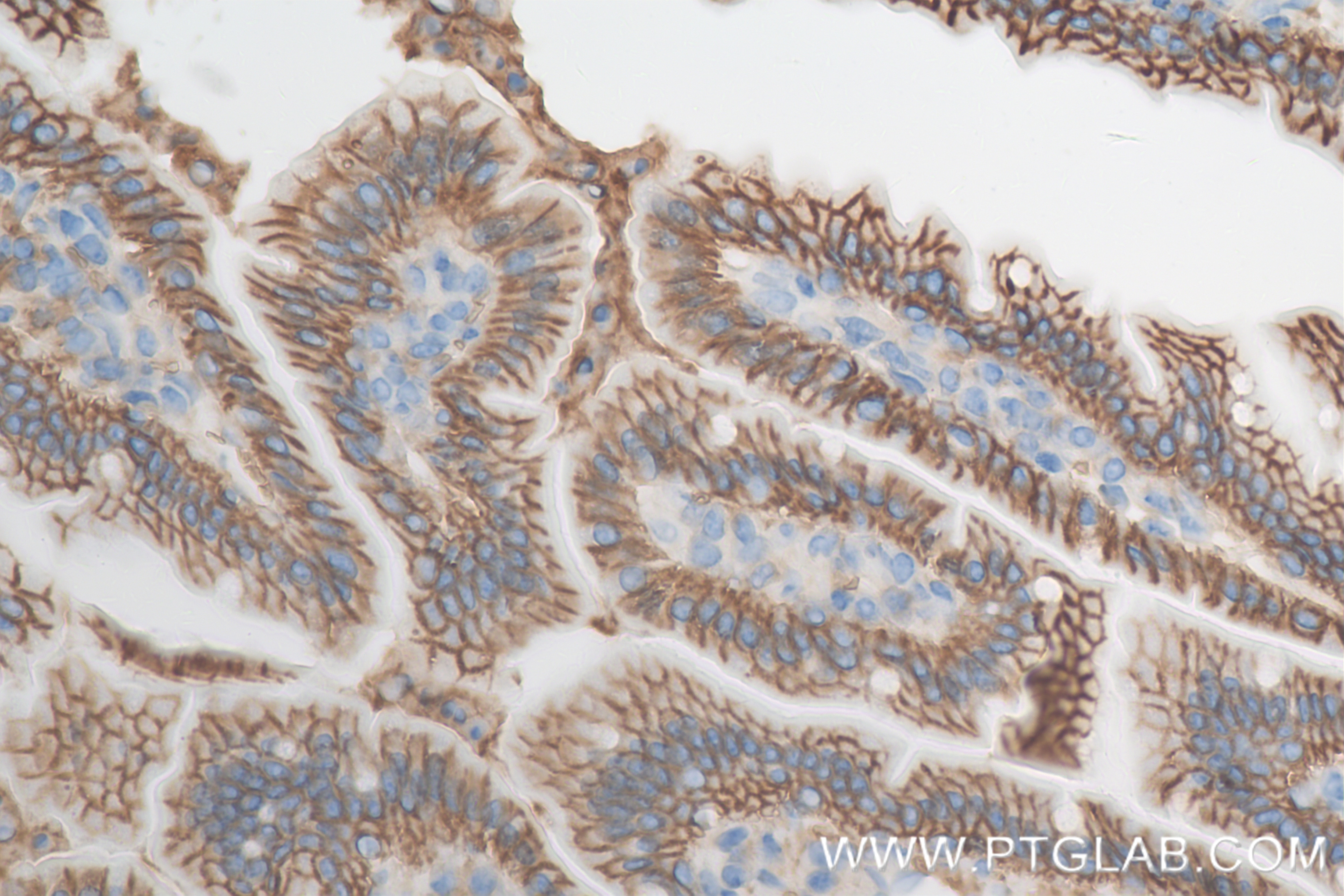 Immunohistochemistry (IHC) staining of mouse small intestine tissue using CD147 Recombinant antibody (84488-6-RR)