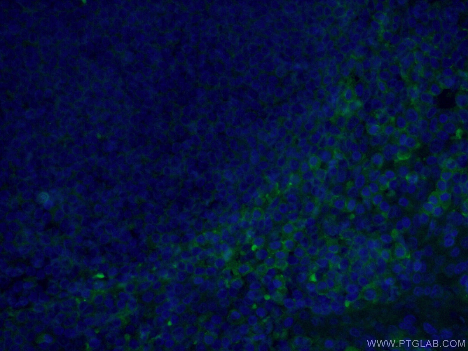 IF Staining of human tonsillitis using CL488-66443