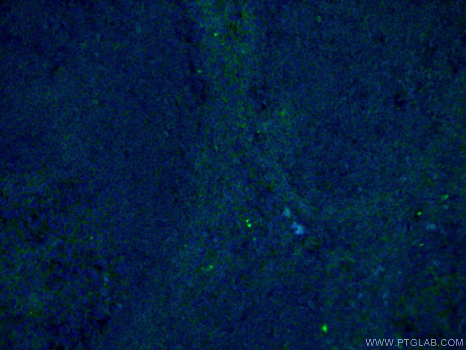 Immunofluorescence (IF) / fluorescent staining of human tonsillitis tissue using CoraLite® Plus 488-conjugated CD147 Monoclonal ant (CL488-66443)
