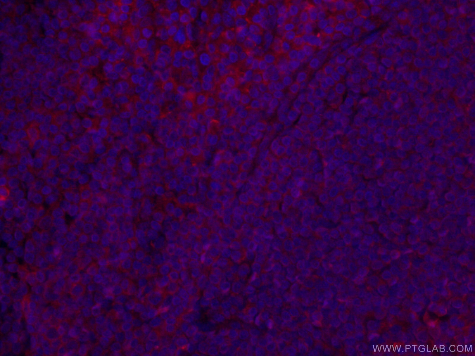 IF Staining of human tonsillitis using CL594-66443
