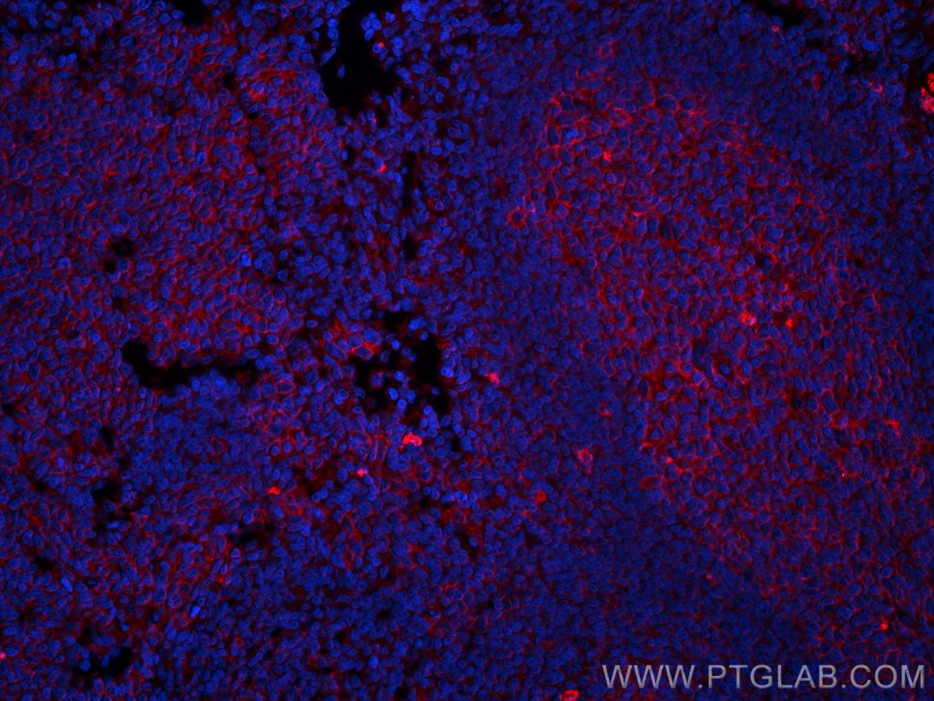 Immunofluorescence (IF) / fluorescent staining of human tonsillitis tissue using CoraLite®594-conjugated CD147 Monoclonal antibody (CL594-66443)