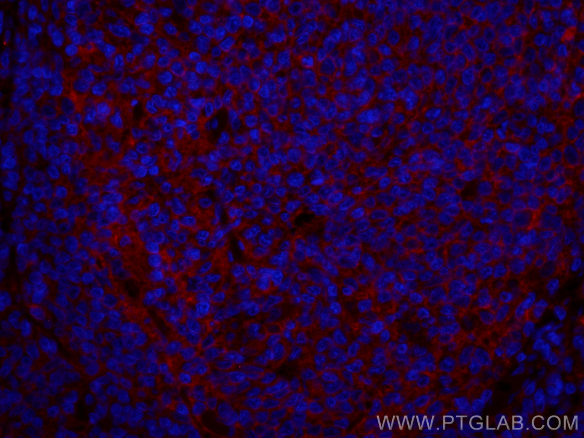 Immunofluorescence (IF) / fluorescent staining of human tonsillitis tissue using CoraLite®594-conjugated CD147 Monoclonal antibody (CL594-66443)