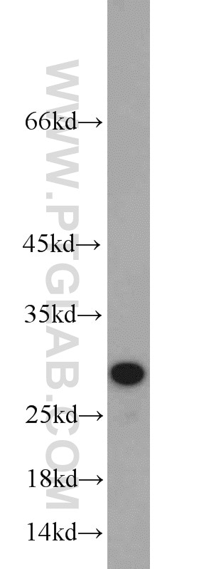 CD151 Polyclonal antibody