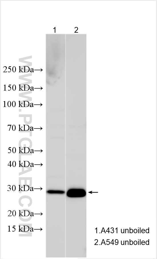 Western Blot (WB) analysis of various lysates using CD151 Polyclonal antibody (27816-1-AP)