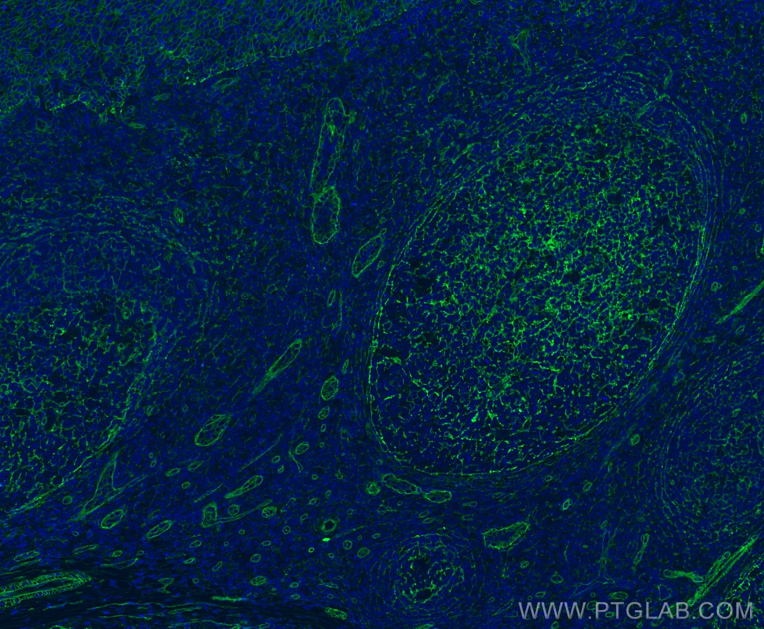 Immunofluorescence (IF) / fluorescent staining of human tonsillitis tissue using CD151 Monoclonal antibody (66567-1-Ig)
